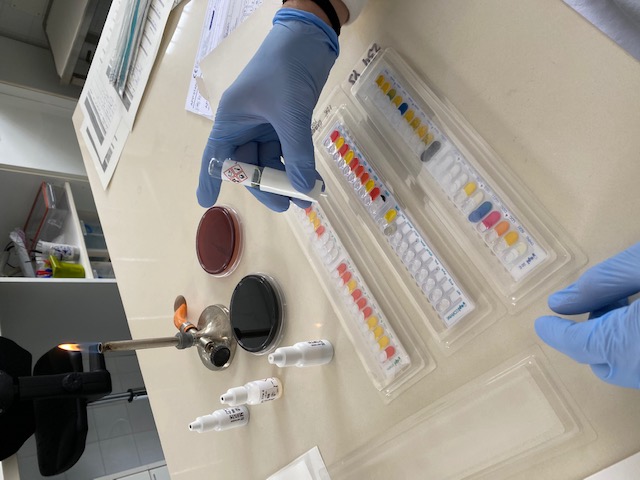 Detalle del instrumental al momento de insertar muestras de sangre para realizar el análisis