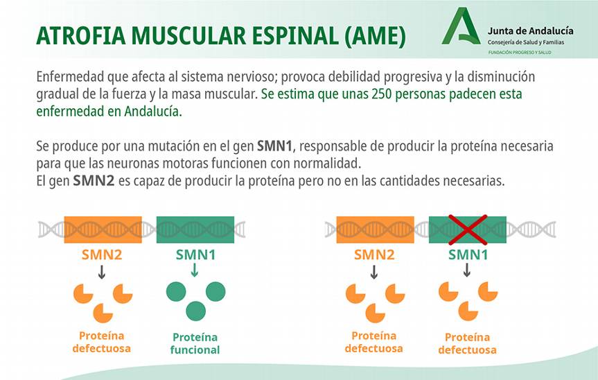 El gráfico explica qué es la Atrofia Muscular Espinal (AME). 