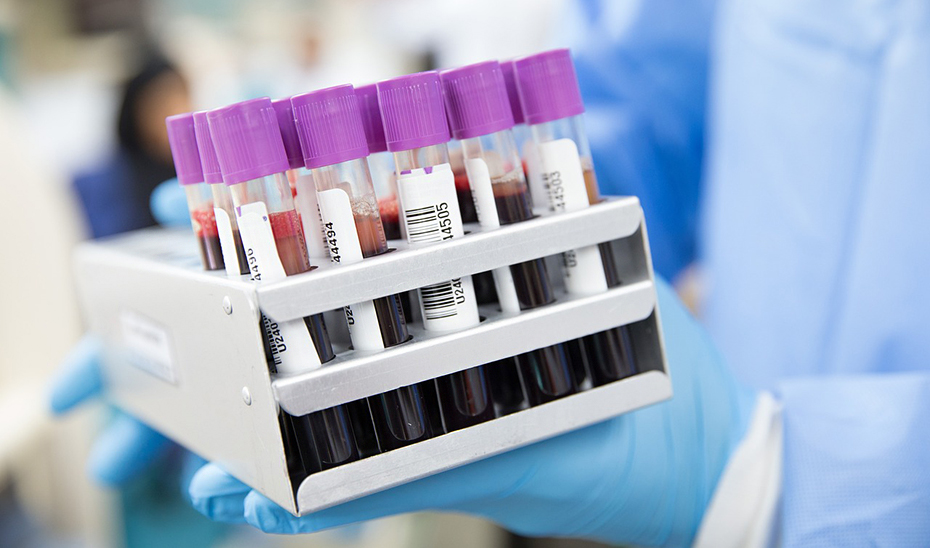 
			      Un trabajador de un laboratorio hospitalario trabaja con muestras de análisis de sangre.			    
			  
