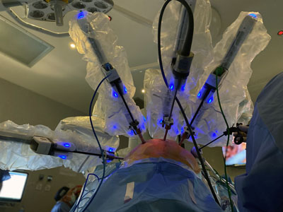 Detalle de los brazos del robot quirúrgico