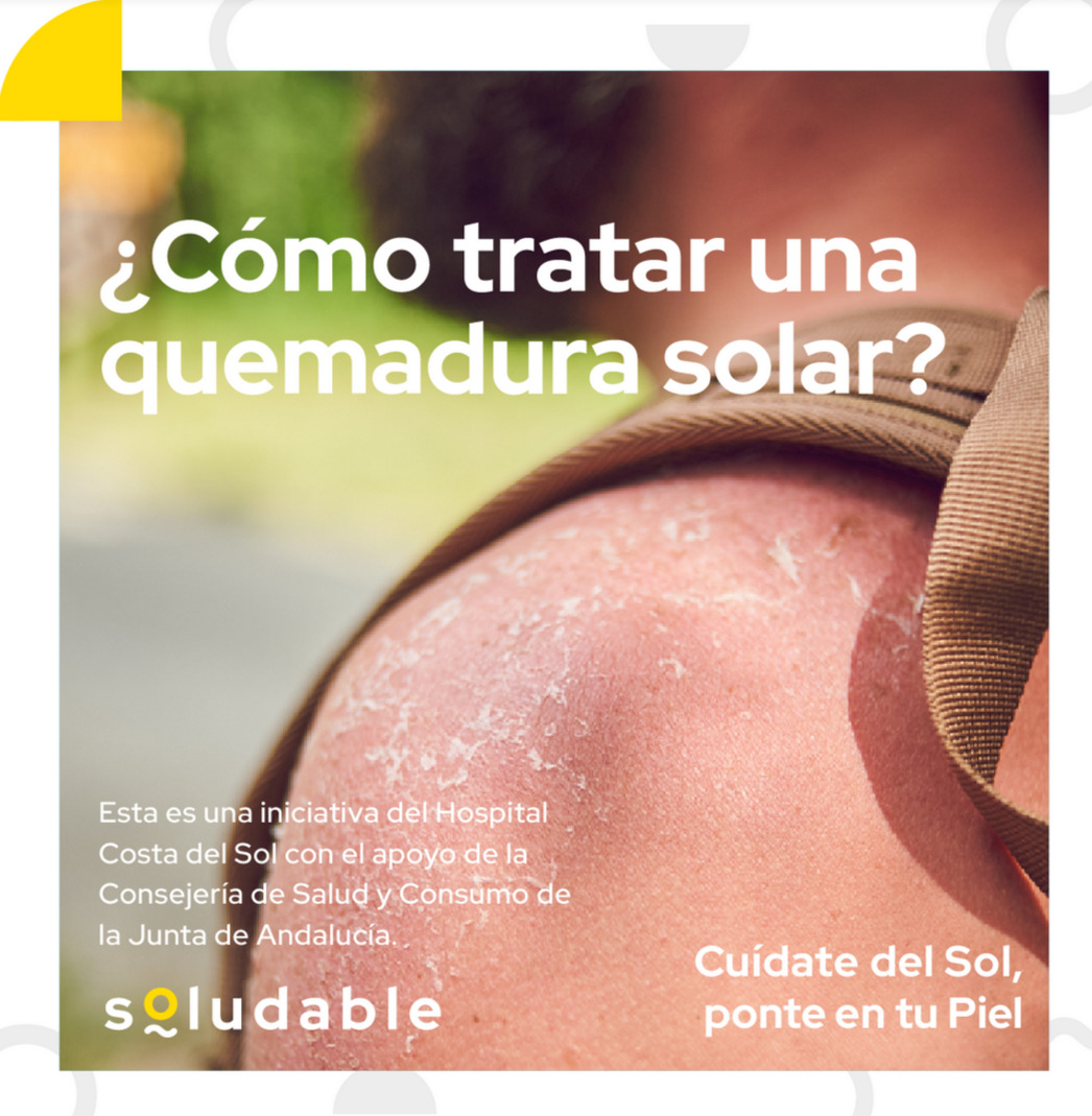 Soludable crea una guía específica con recomendaciones frente a las quemaduras solares